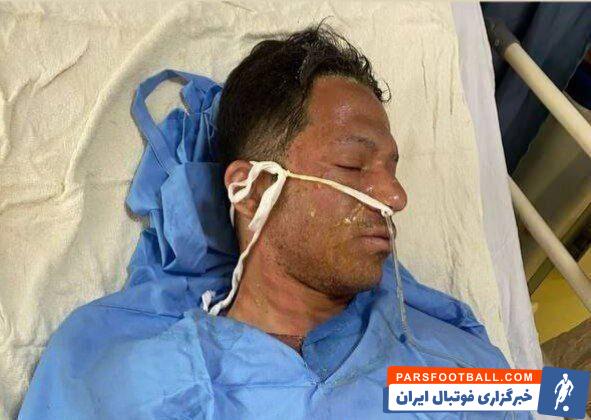 عکس دلخراش از سوختگی پرسپولیسی سابق