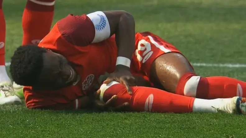 پارگی رباط آلفونسو دیویس در دیدار کانادا - آمریکا