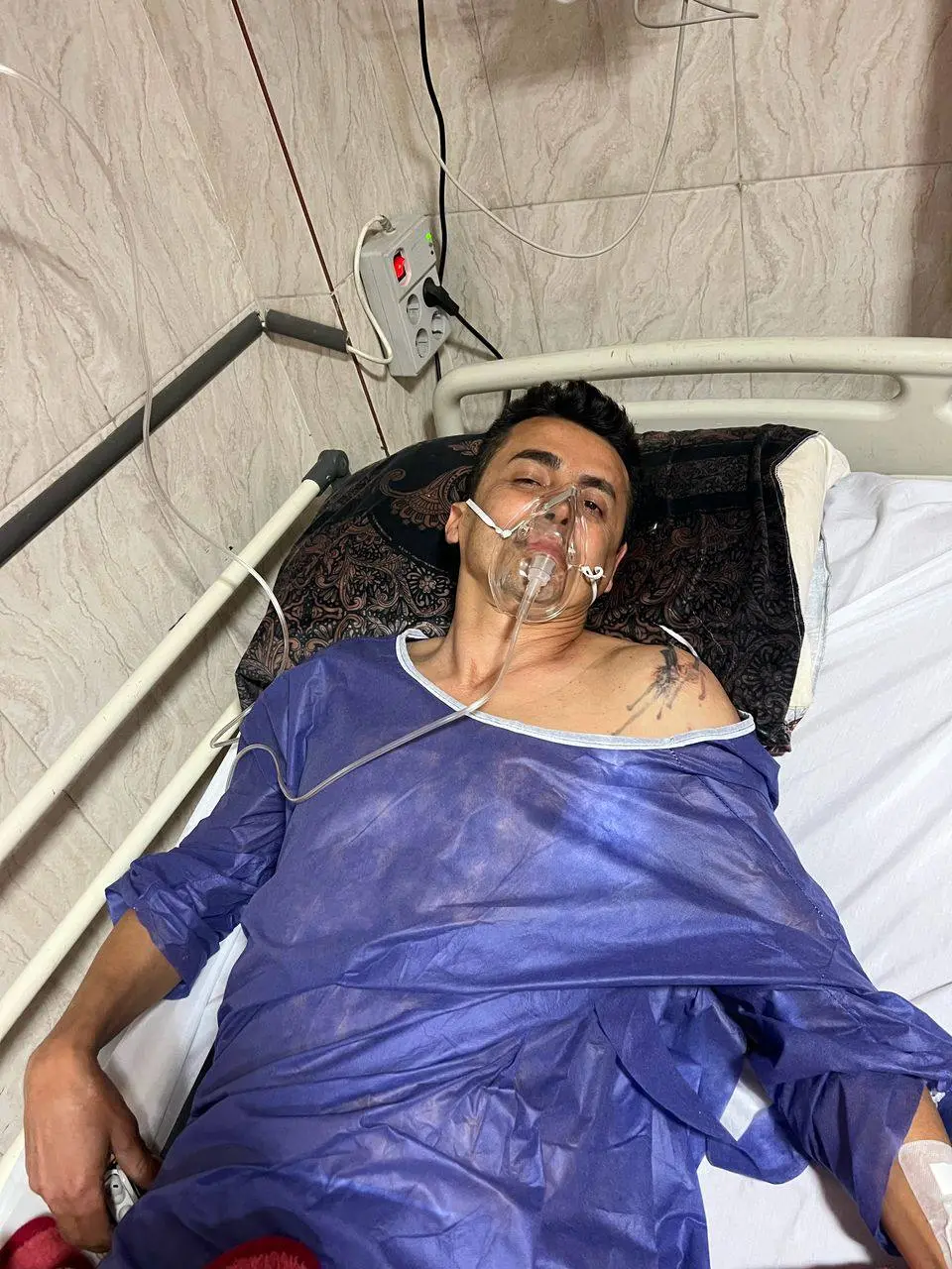 حادثه تلخ برای مهدی امیر آبادی: سقوط شش متری (عکس)