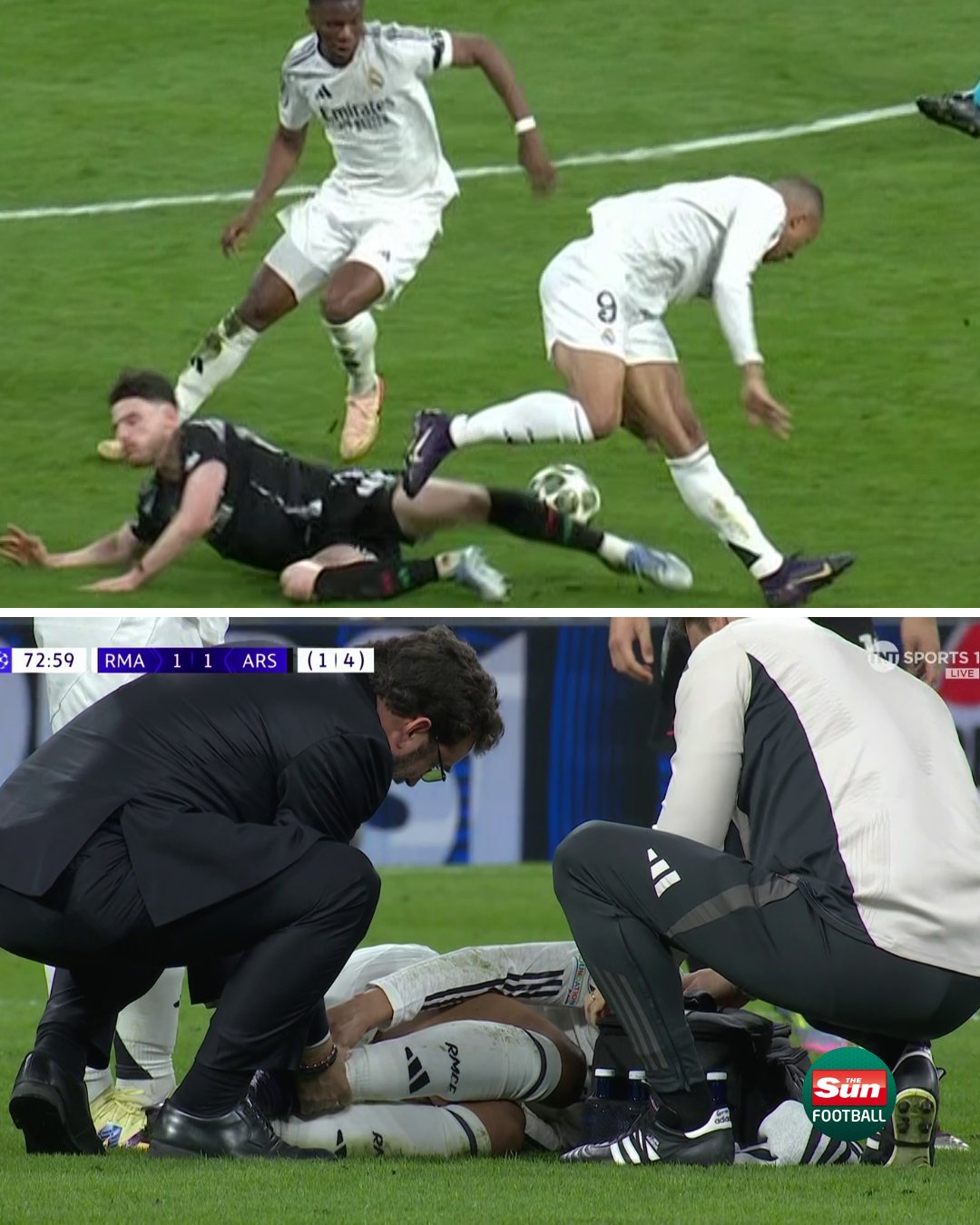 مصدومیت کیلیان امباپه - بازی رئال مادرید و آرسنال در مرحله یک چهارم نهایی لیگ قهرمانان اروپا - فصل 25-2024 - سانتیاگو برنابئو