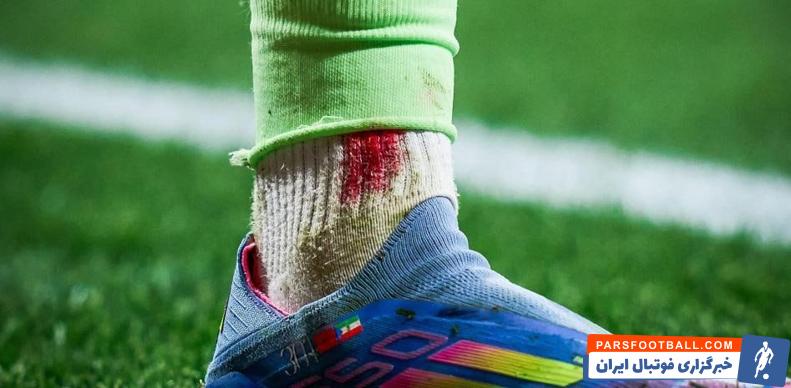 خونریزی پای یامین یامال در دیدار برابر اتلتیکومادرید در جام حذفی