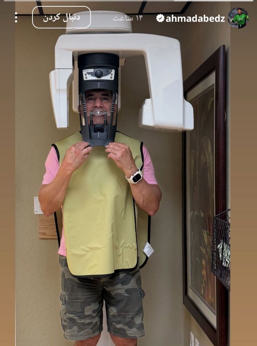 چهره عجیب احمدرضا عابدزاده!+ عکس