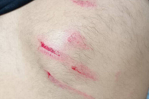 پرونده «تبرکِشی» یزدی‌ها روی میز کمیته انضباطی فدراسیون + فیلم درگیری