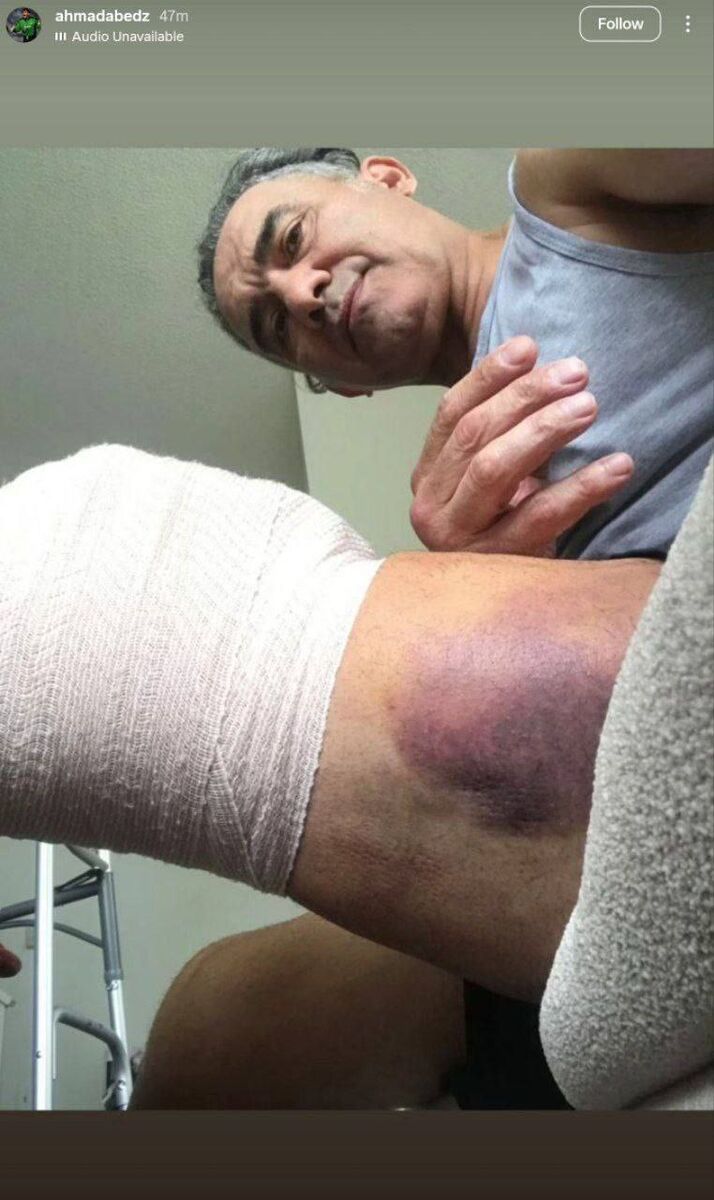 استوری احمدرضا عابدزاده