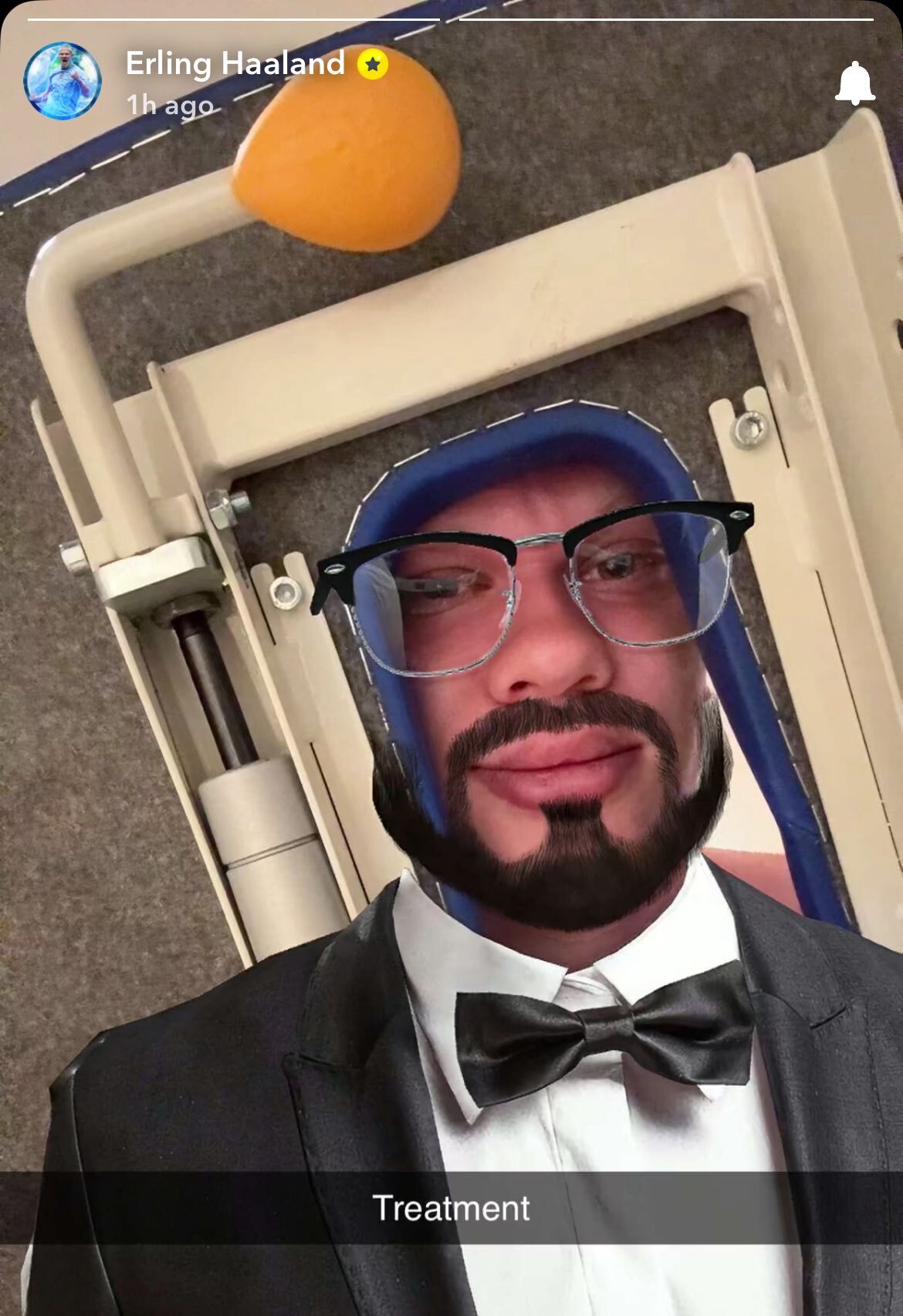 ارلینگ هالند رونمایی کرد: ریش بهم میاد؟