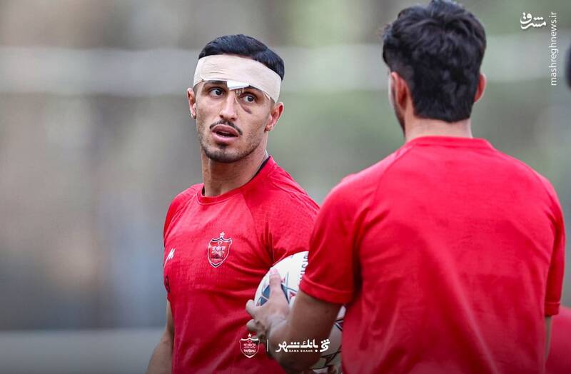 4477580 واضحترین تصویر از جراحت چشم مهاجم پرسپولیس