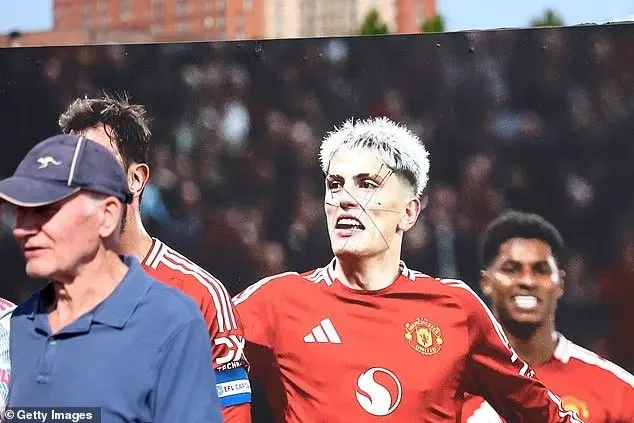 img_20250817_200348_496 چهره ستاره مغضوب یونایتد خطخورده شد! (عکس)