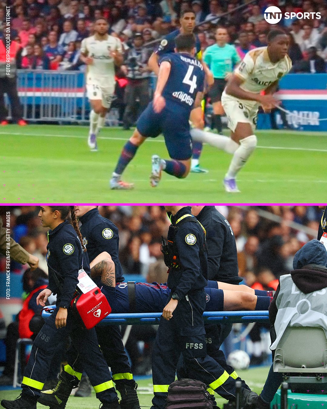 مصدومیت لوکاس برالدو - پاری سن ژرمن