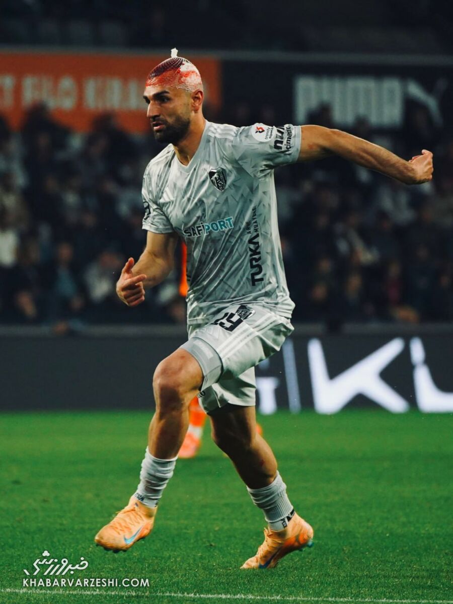 مصدومیت سردار دورسون