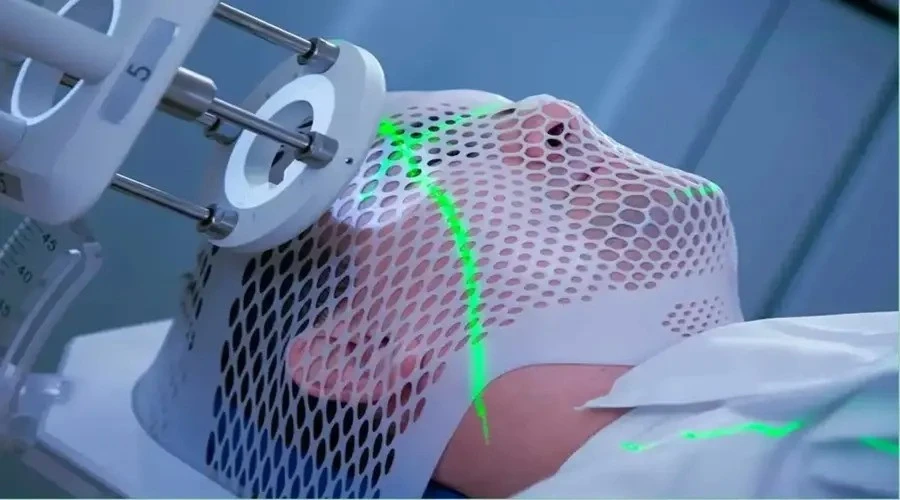 lip-and-tongue-cancer-radiotherapy رادیوتراپی سرطان لب و زبان: آنچه که باید درمورد آنها بدانید! - دکتر حسین یحیی زاده
