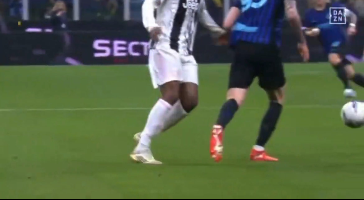 تقابل کالولو و باستونی