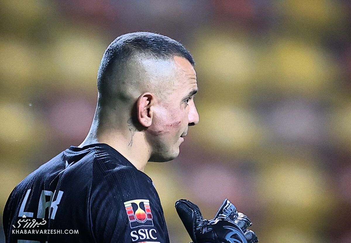 422459 ستاره سابق پرسپولیس در نقش «صورت زخمی»/ ماجرای تغییر سناریو با حرکت شجاعانه +عکس