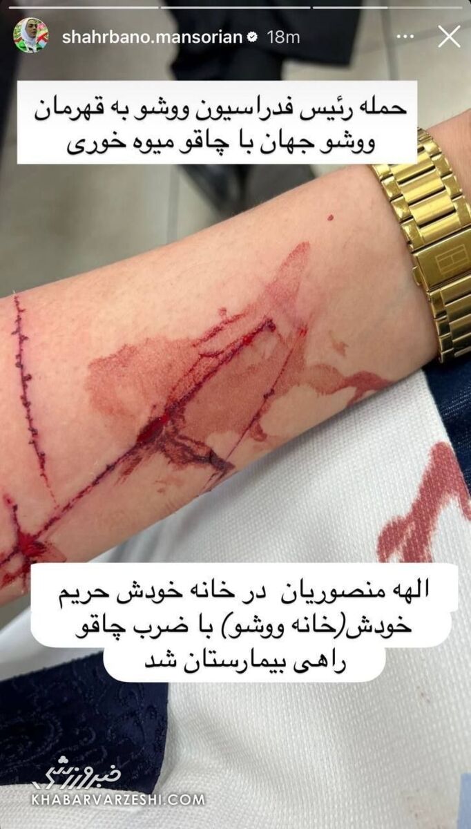 430097 استوری شهربانو منصوریان