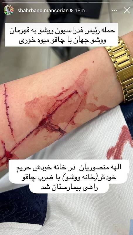 عکس/ ادعای شهربانو منصوریان با انتشار دست خونین خواهرش