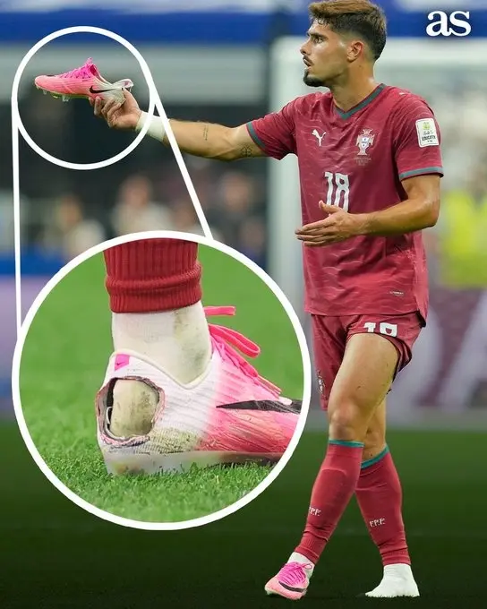 1-173 مبارزه ستاره پرتغال با یک سندروم دردناک
