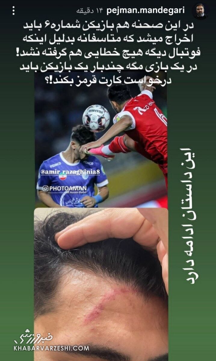 443557 استوری ماندگاری