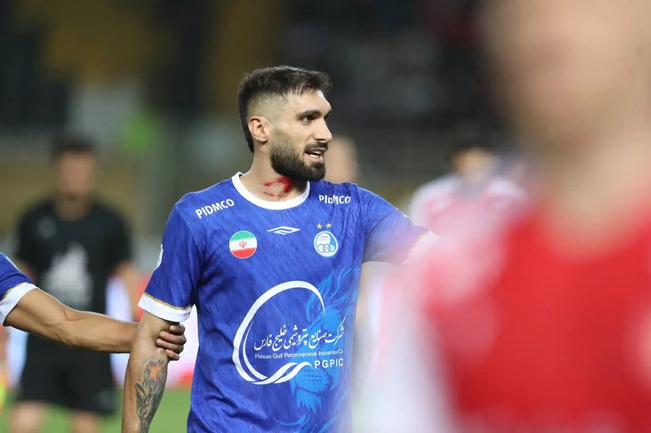 d8a7db8cd8aad8a7 گلوی آقاسی را بریدند (عکس)