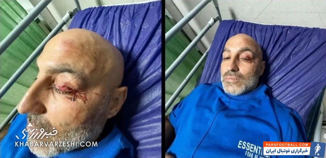 رامین محرم نژاد بازیکن پیشین استقلال به خاطر تصادف شدید در بیمارستان بستری شد