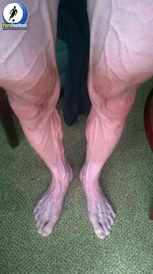 بارتوژ هوزارسکی