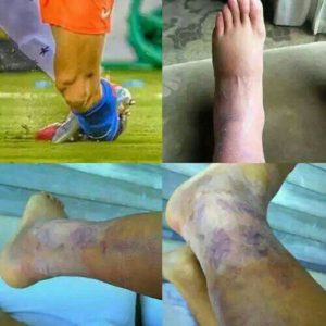 الکسیس سانچز