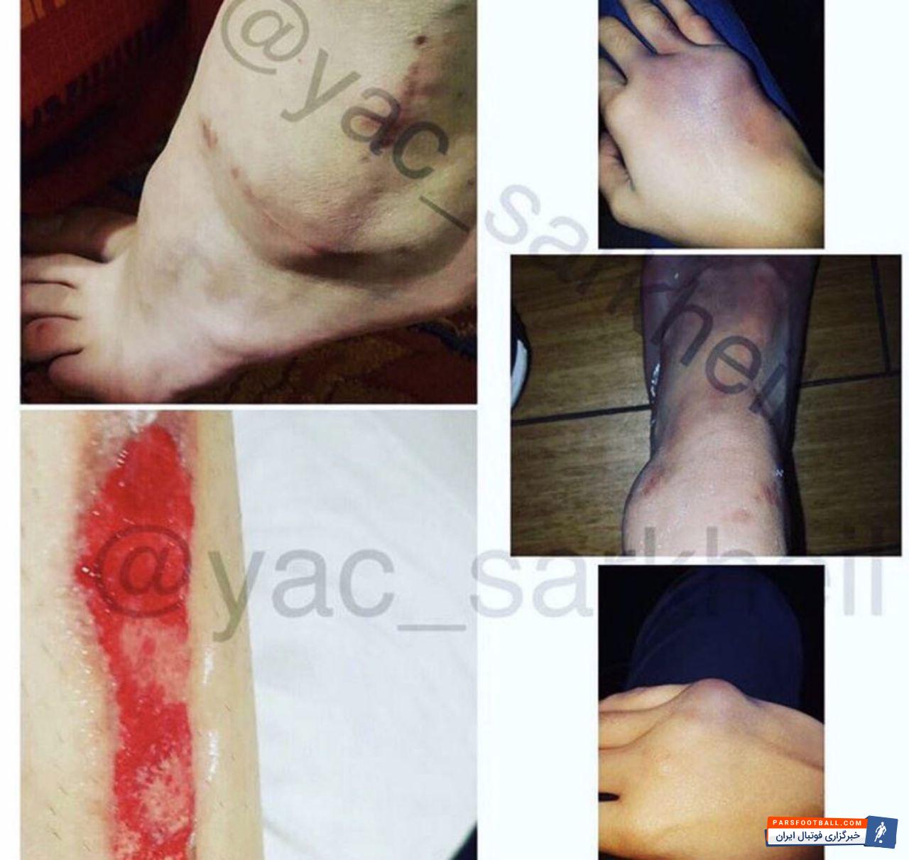 مصدومیت های کیمیا علیزاده