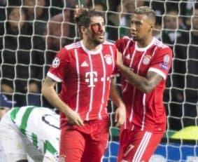 برای بایرن مونیخ نویر، مولر، برنات ، ریبری ، کیمیش و بواتنگ مصدوم هستند