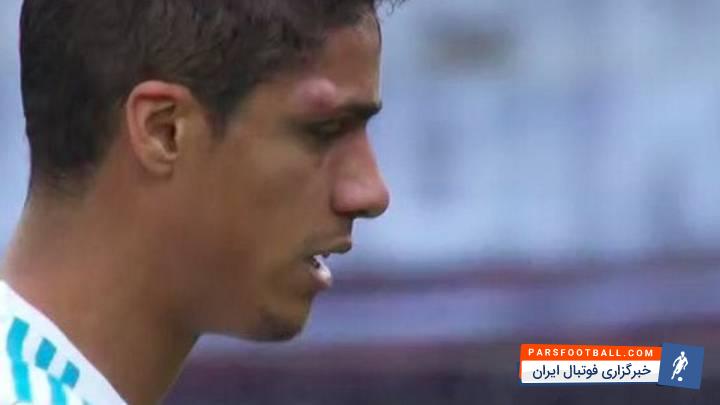 رافائل واران