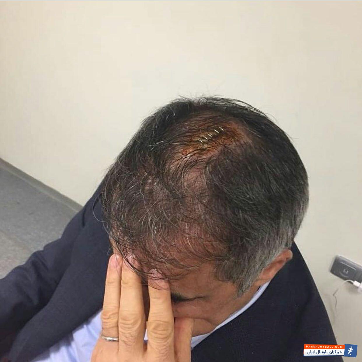 فنرباغچه و بشیکتاش