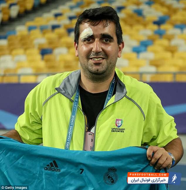 کریس رونالدو در تمرینات با شوتی سنگین باعث جراحت ابروی یک حبرنگار شد