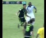 صحنه هایی از مصدومیت دلخراش بازیکنان در بازی فوتبال