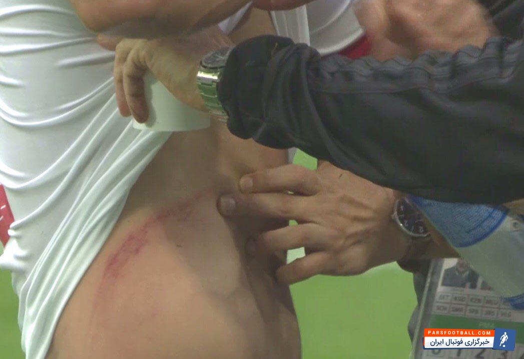 تصویری از مصدومیت دلخراش امید ابراهیمی در دیدار برابر مراکش