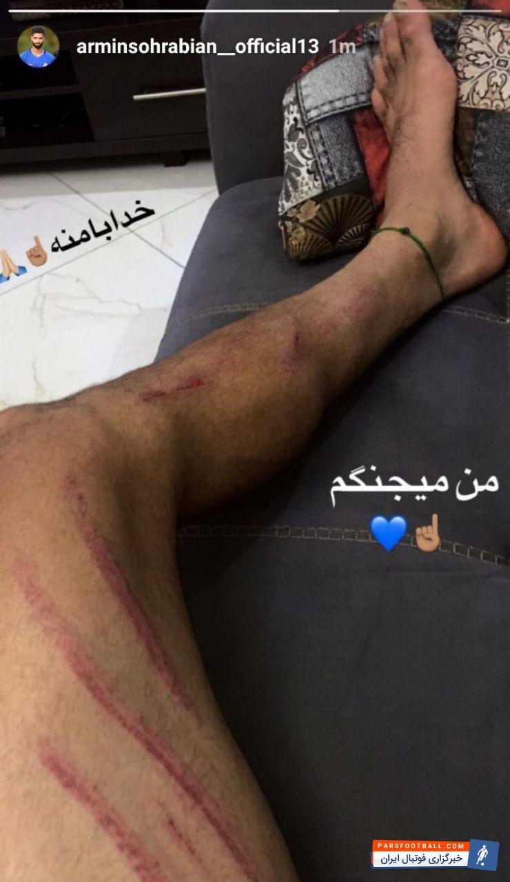 آرمین سهرابیان