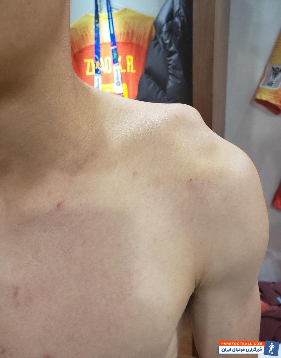 چند روز بعد از ناکامی تیم ملی چین در مصاف با ایران و وداع دردناک با جام ملت های آسیا رسانه های این کشور از اتفاقی عجیب در تیم ملی چین پرده برداشتند.