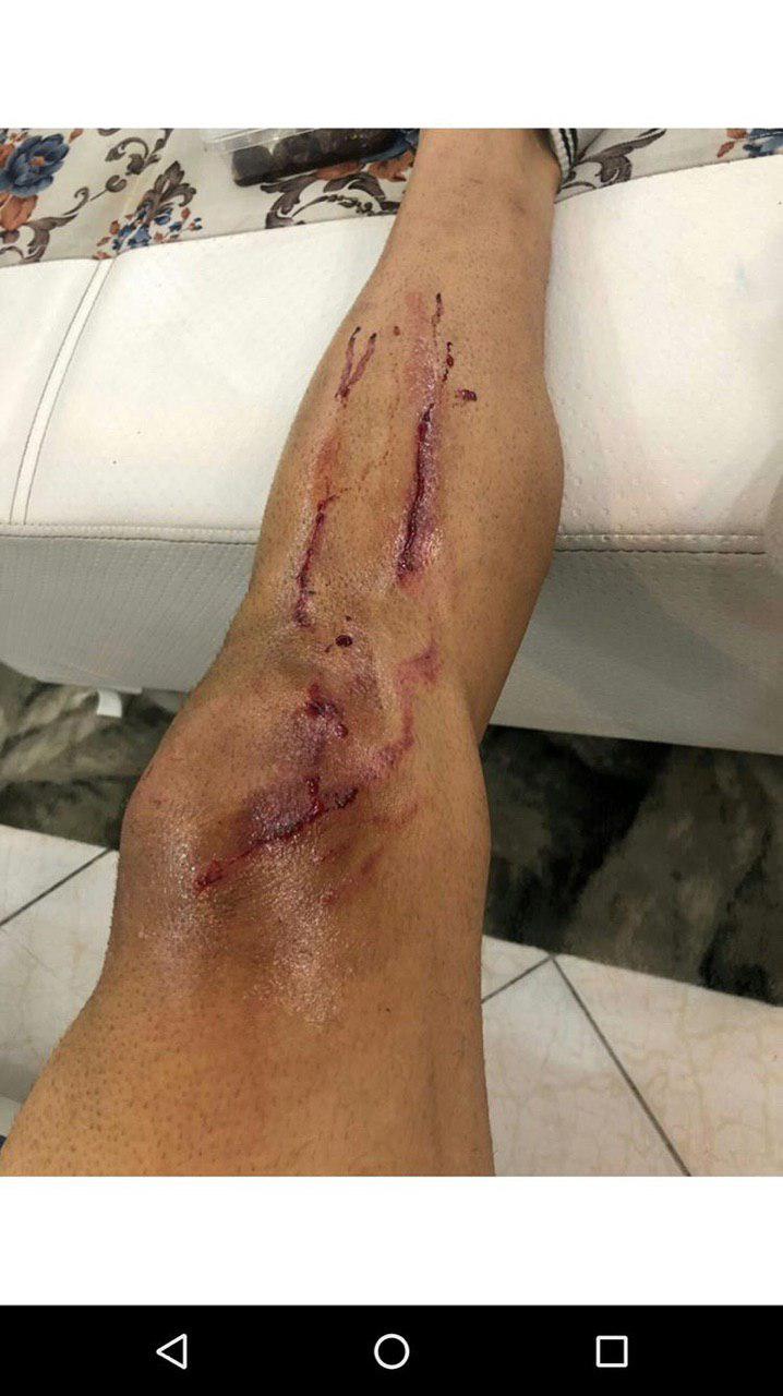 بهنام برزای بازیکنی بود که تک گل گل گهر را در بازی با استقلال در ریباند پنالتی زد اما بهنام برزای در جریان بازی با مصدومیتی نسبتا شدید روبرو شد.