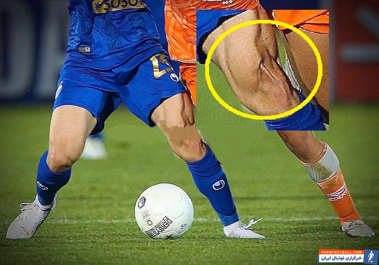 شجاعیان از دیشب این واقعیت تلخ را قبول کرده شجاعیان برای بازگشت هر چه سریع تر به میادین نیازمند حمایت هواداران از همه مهم تر مراقبت های پزشکی است.