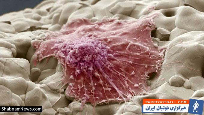 سرطان و راه های پیشگیری از آن