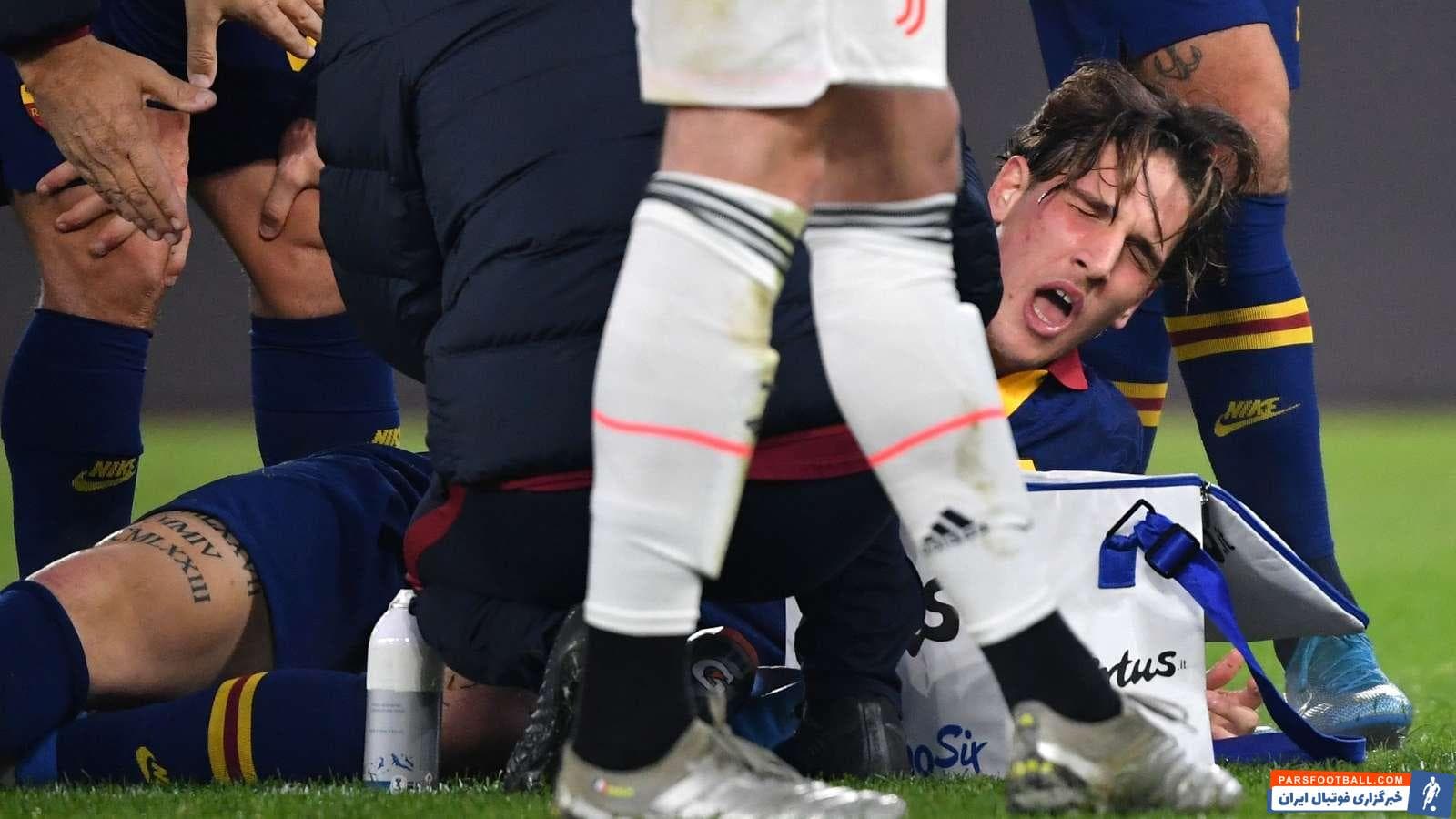 باشگاه رم تایید کرد که نیکولو زانیولو هافبک ملی پوش ایتالیایی، در دیدار امشب جالوروسی مقابل یوونتوس، از ناحیه لیگامنت زانو دچار آسیب دیدگی شده است.