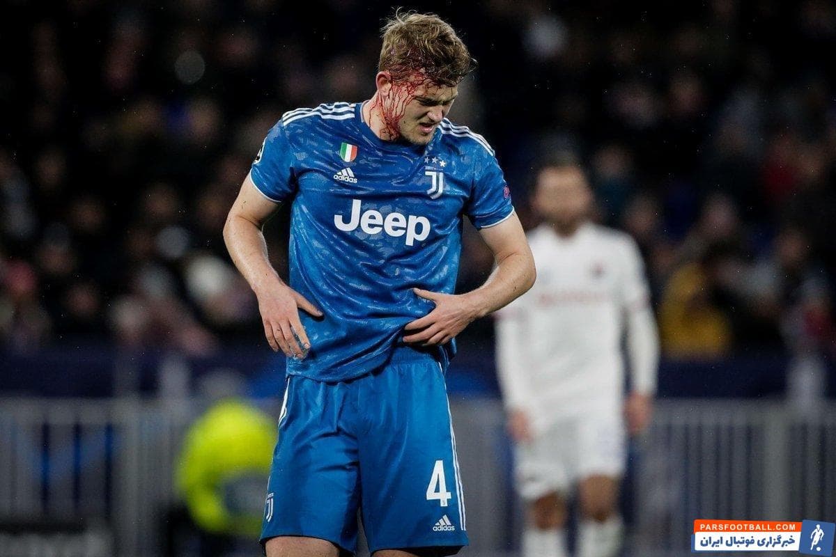 دی لیخت مصدومیت شدید ماتیس دی‌لیخت از ناحیه سر در بازی دیشب این تیم مقابل لیون و خونریزی شدید او واکنش‌های زیادی به دنبال داشته و بسیار جنجالی بوده است.