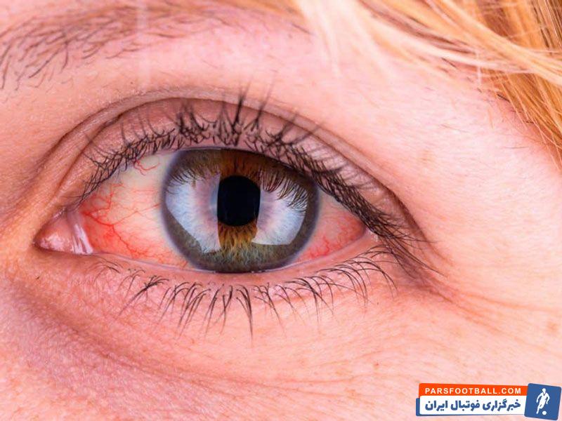 نکاتی برای سلامتی دستگاه گوارش