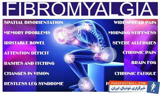 بهترین درمان فیبرومیالژیا