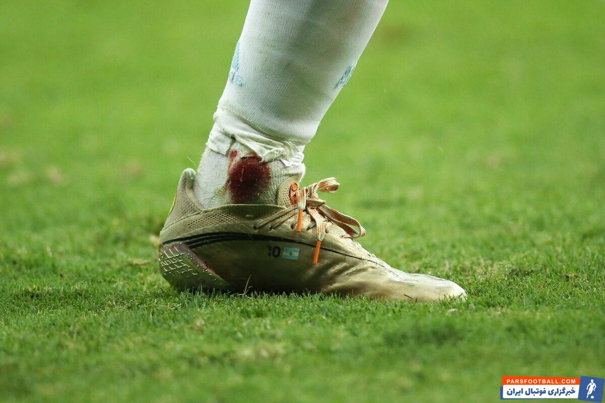 لیونل مسی کاپیتان آلبی سلسته در این بازی از جان و دل برای تیم ملی کشورش مایه گذاشت در صحنه ای به شدت مصدوم شد.